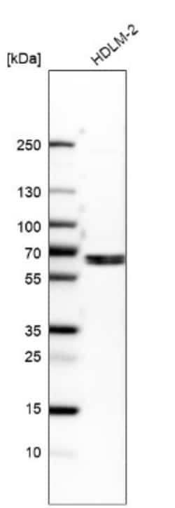 EOGT/AER61 Antibody, Novus Biologicals:Antibodies:Primary Antibodies